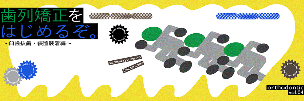 歯列矯正をはじめるぞ。〜臼歯抜歯、装置装着編〜