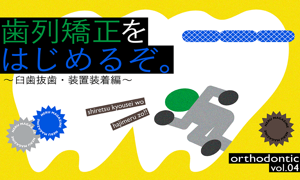 歯列矯正をはじめるぞ。〜臼歯抜歯、装置装着編〜
